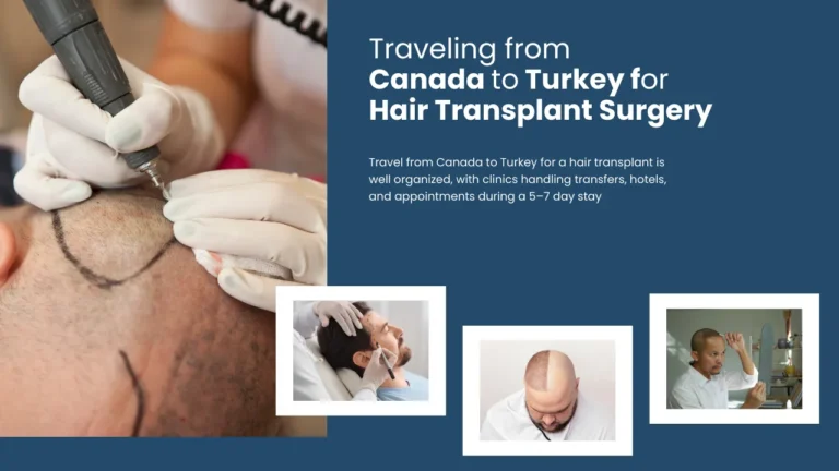 Traveling-from-Canada-to-Turkey-for-Hair-Transplant-Surgery--768x432