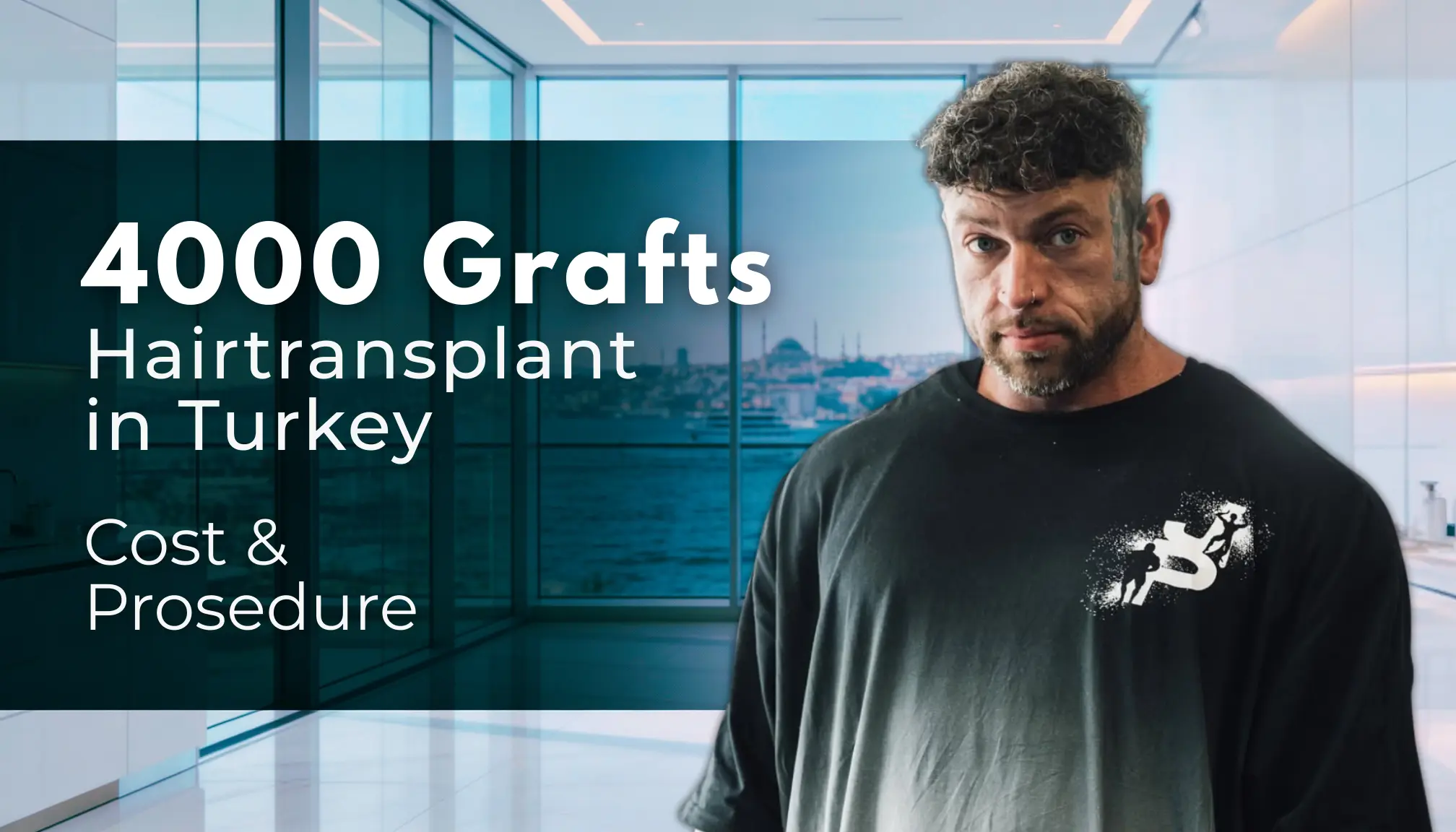 4000 Grafts Hair Transplant Turkey – Cost and Procedure