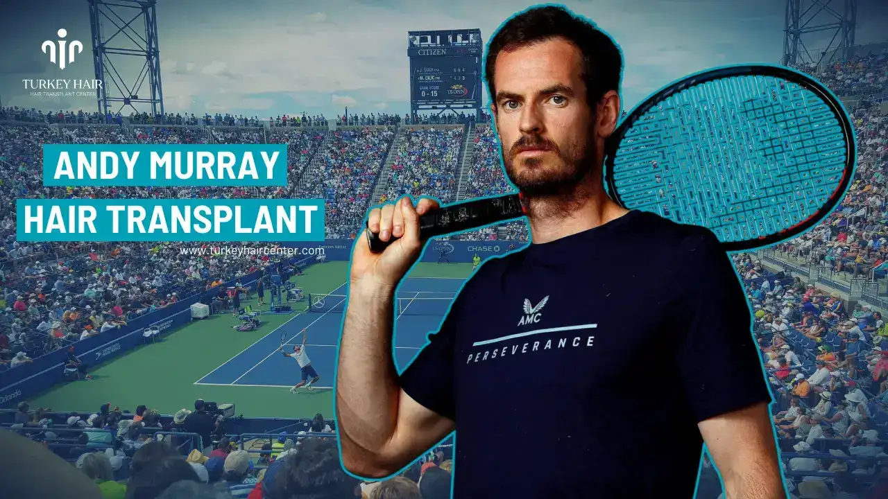 Britain’s Number 1 Tennis Player Andy Murray’s Hair Transplant