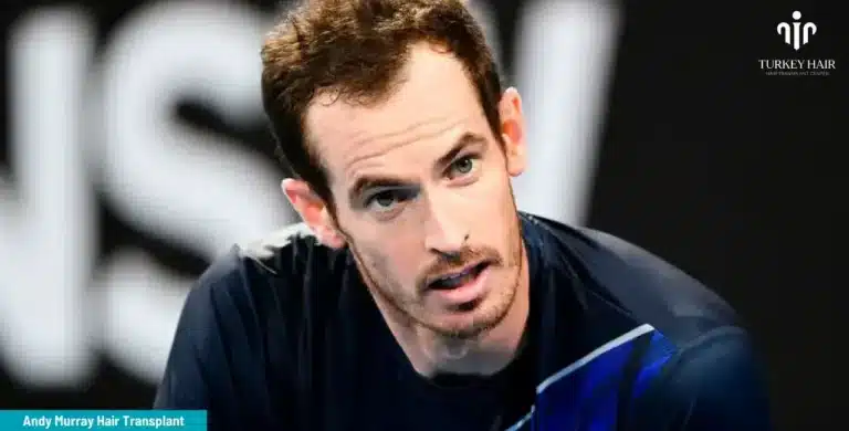 ANDY-MURRAY-HAIR-TRANSPLANT-3-1-768x390