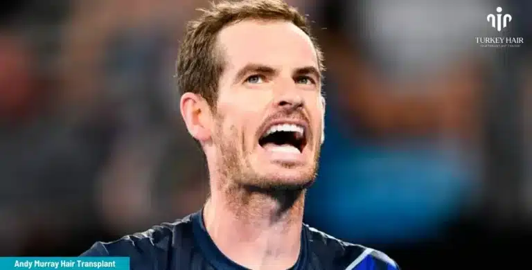 ANDY-MURRAY-HAIR-TRANSPLANT-4-1-768x390