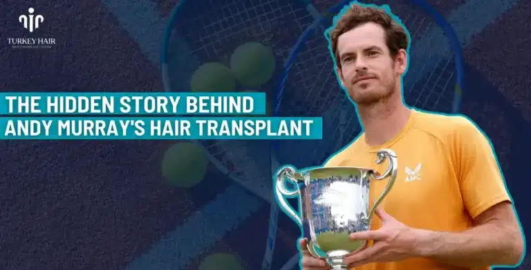 ANDY-MURRAY-HAIR-TRANSPLANT-5-1-768x390