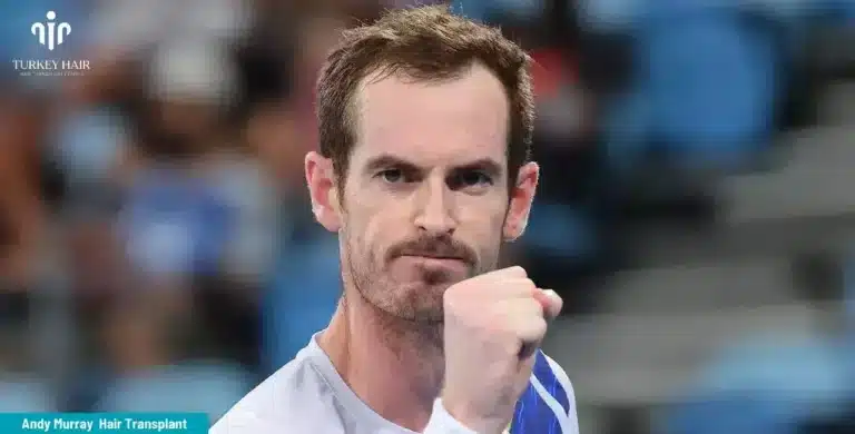 ANDY-MURRAY-HAIR-TRANSPLANT-6-1-768x390