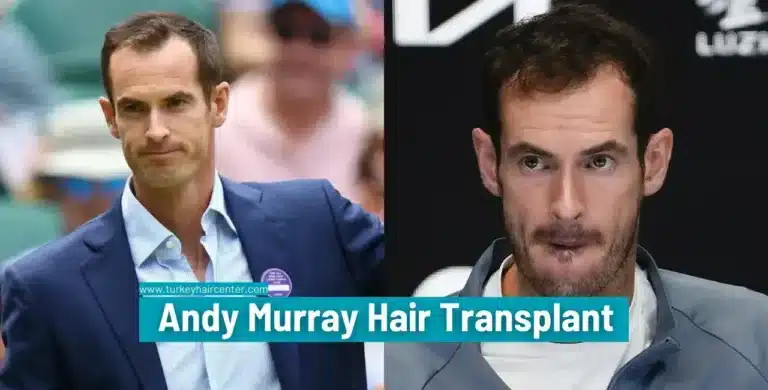 ANDY-MURRAY-HAIR-TRANSPLANT-7-1-768x390