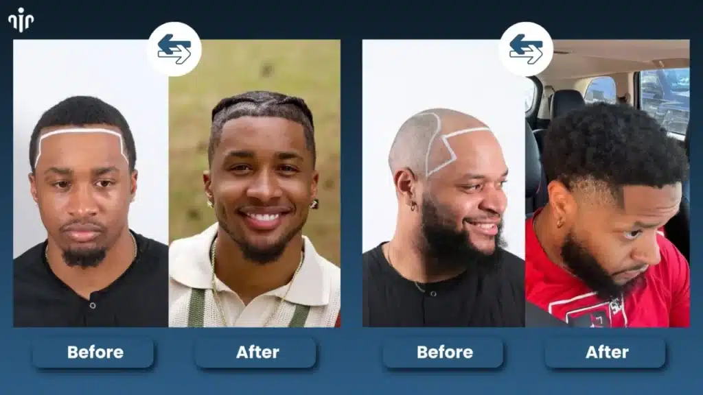 Before-and-After-Hairstyle-Comparisons-1280x720