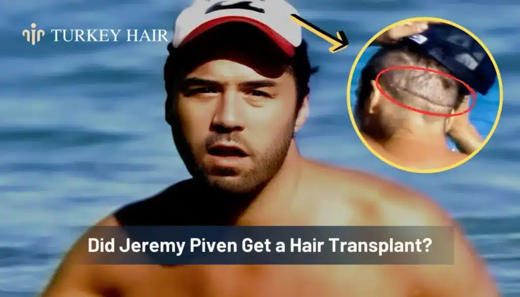 Did-Jeremy-Piven-Get-a-Hair-Transplant-1344x768