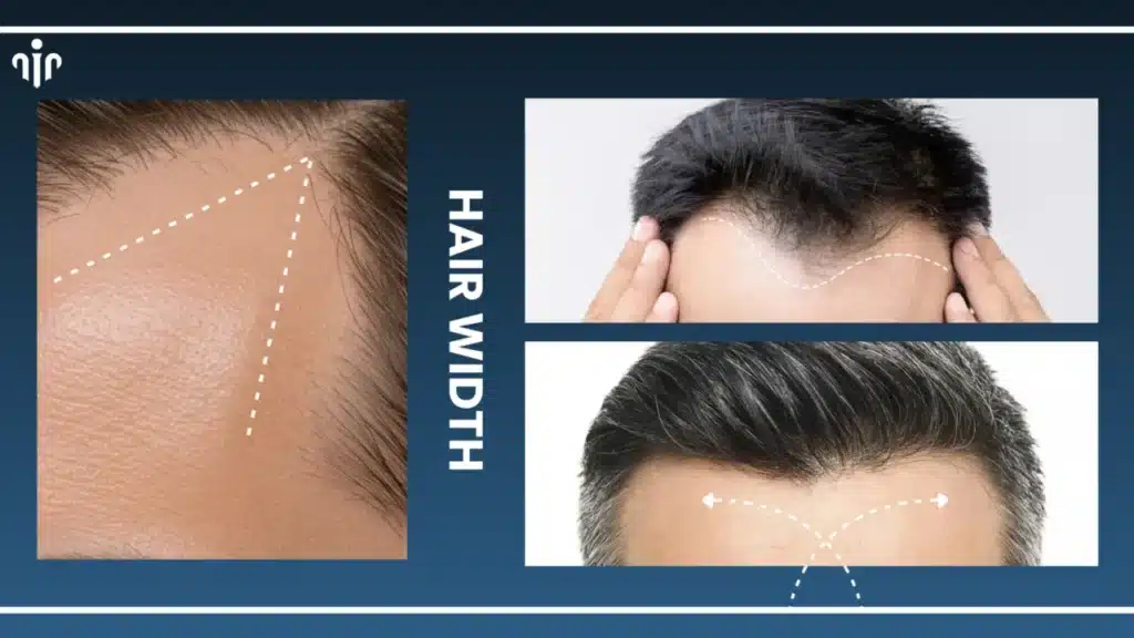 Haircuts-by-Hairline-Type-1280x720