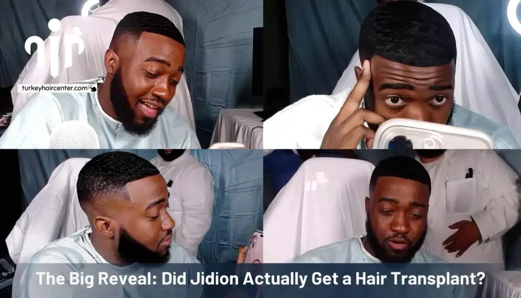 Jidion-Adams-Hairline-1024x587