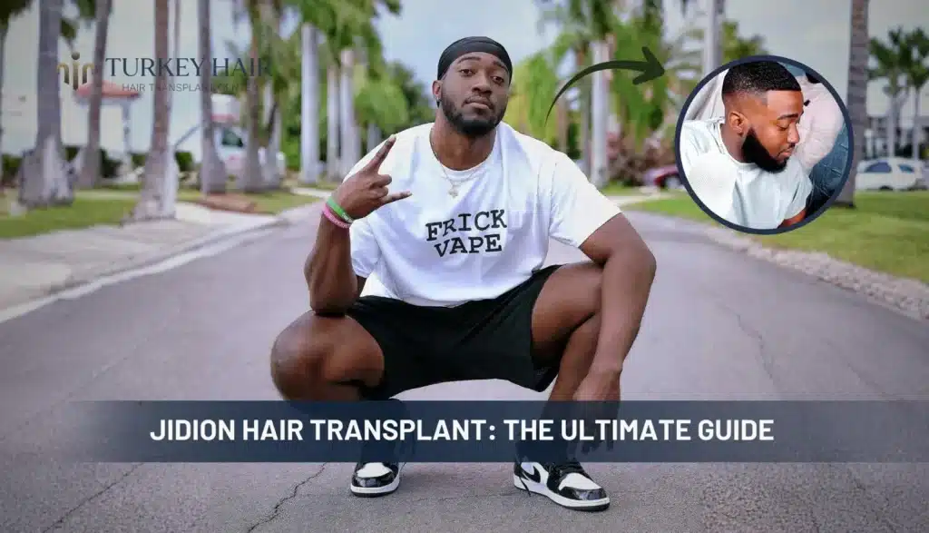 Jidion-Hair-Transplant-1024x587