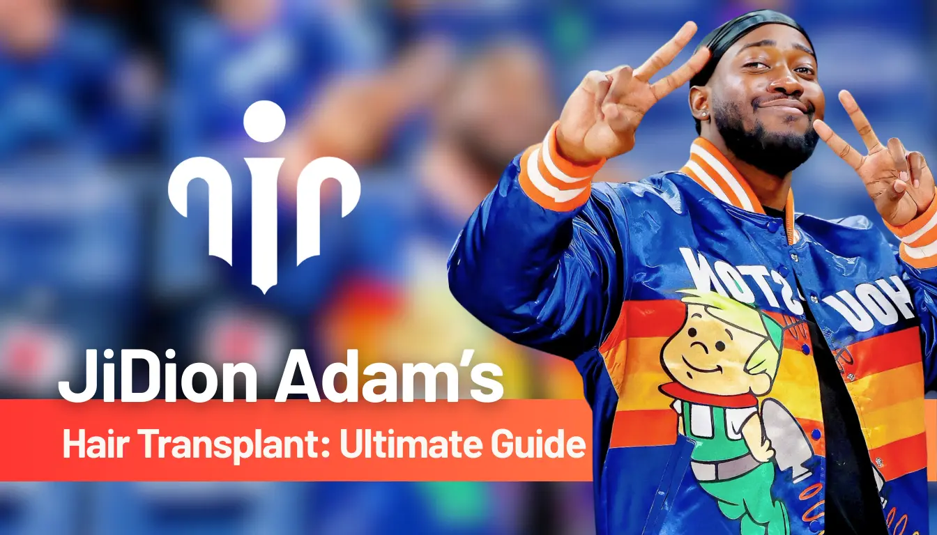 Rumors About JiDion Hair Transplant Before and After