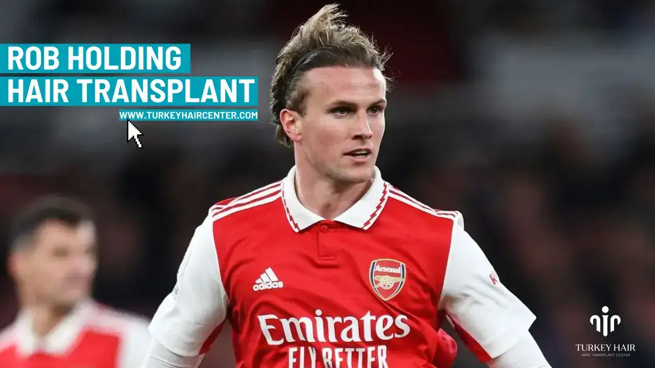 Rob Holding Hair Transplant