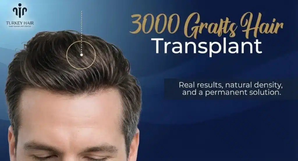 Surgeon-and-Team-1200x650