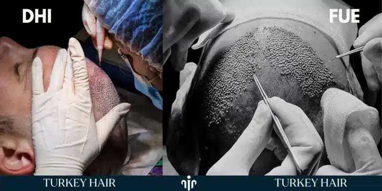 Techniques-Used-for-Widows-Peak-768x384