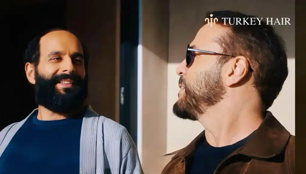 Was-Jeremy-Pivens-Hair-Transplant-Successful-1344x768