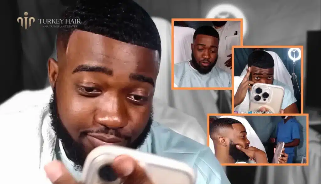 Youtuber-Jidion-Hair-Transplant-1024x587