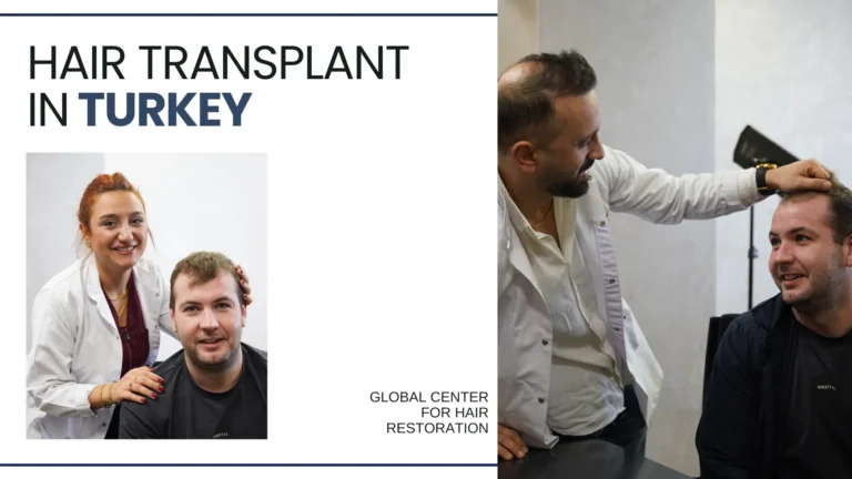 hair-transplant-in-Kuwait-2-768x432