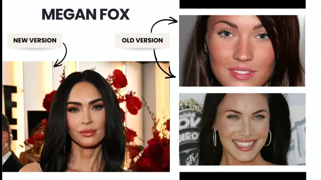 Eyebrow Transplant In Turkey – Cost, Before & After 12 Eyebrow Transplant In Turkey – Cost, Before & After Hair Restoration Excellence You Can Trust