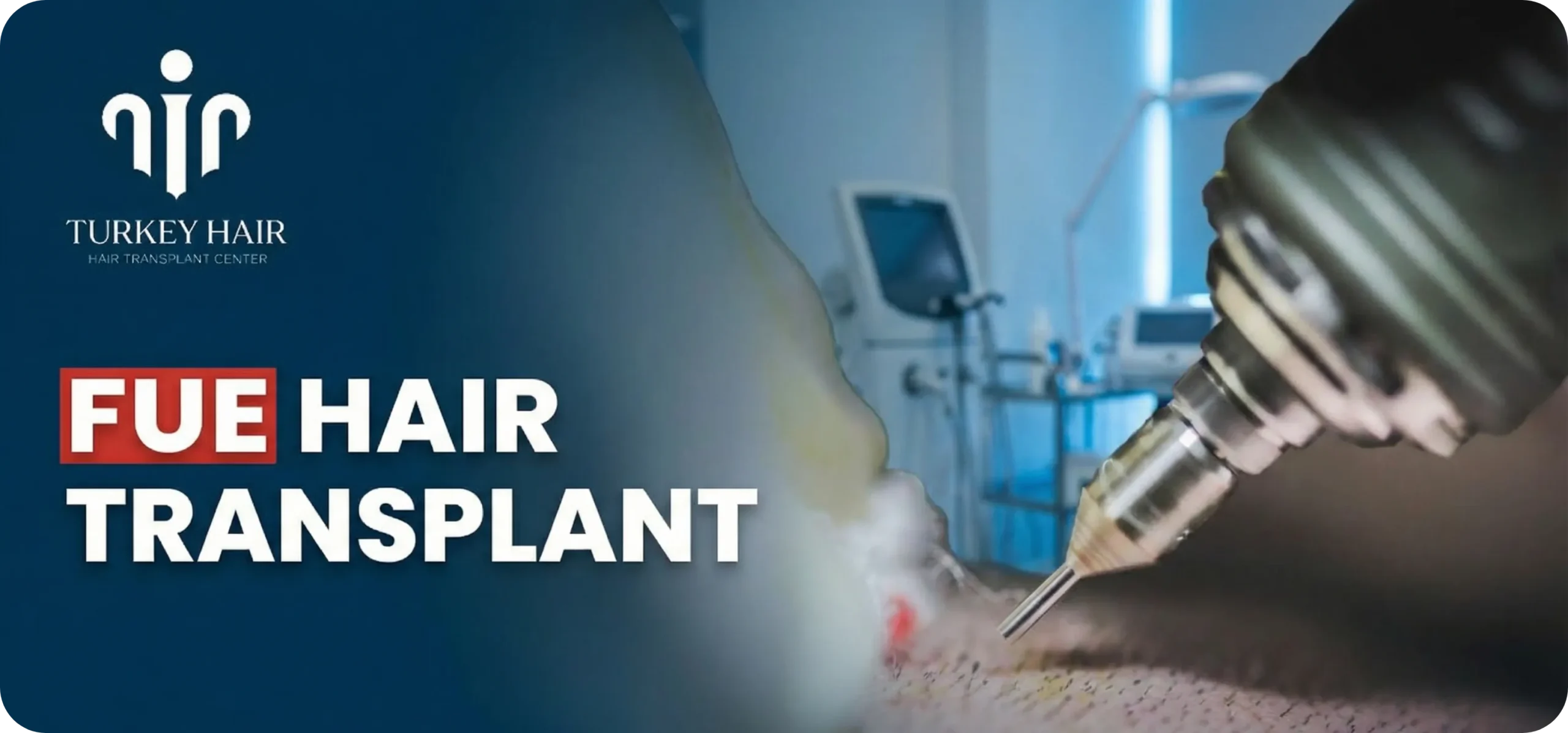 Fue Hair Transplant In Turkey – Cost, Before & After Hair Restoration Excellence You Can Trust