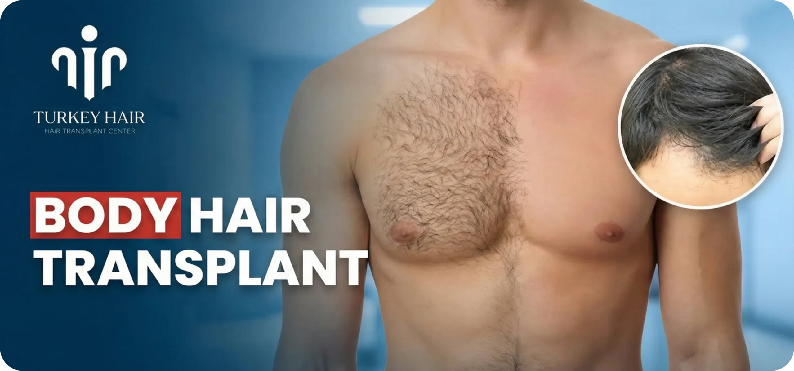 Body Hair Transplant In Turkey: Cost, Procedure & Before-After Hair Restoration Excellence You Can Trust
