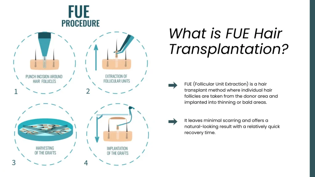 Fue Hair Transplant In Turkey – Cost, Before & After 7 Fue Hair Transplant Technique With Follicle Extraction And Implantation For Natural Hair Restoration