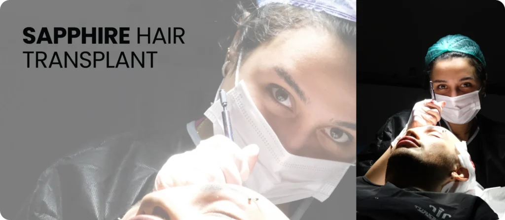 Sapphire Hair Transplant Sapphire Hair Transplant