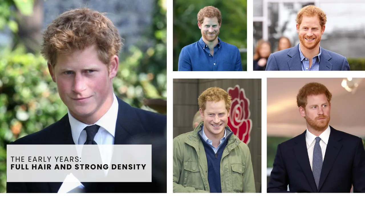 Prince Harry Early Years Hair Density and Hairline Appearance Young Prince Harry with full hair density shown across multiple public appearances during his early years.