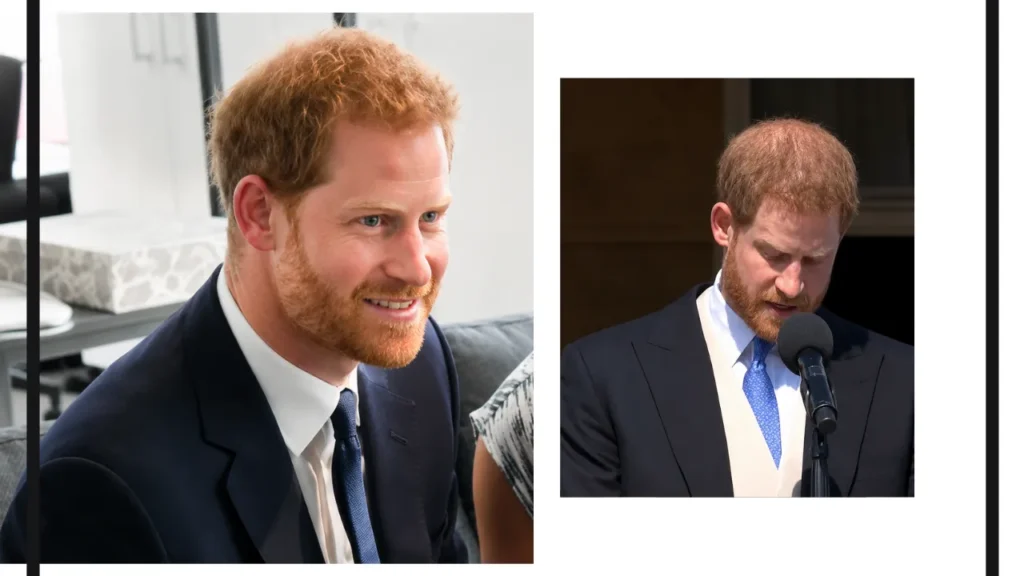 Prince Harry hair loss comparison showing differences in crown density and thinning hair during public appearances.