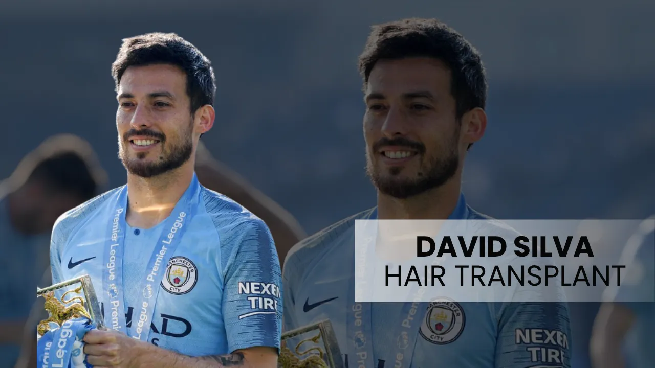 David Silva Hair Transplant: Before & After