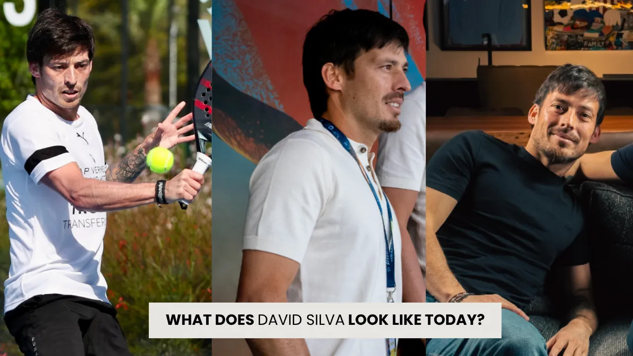 David Silva hair transplant before and after comparison showing hairline restoration and improved hair density over time