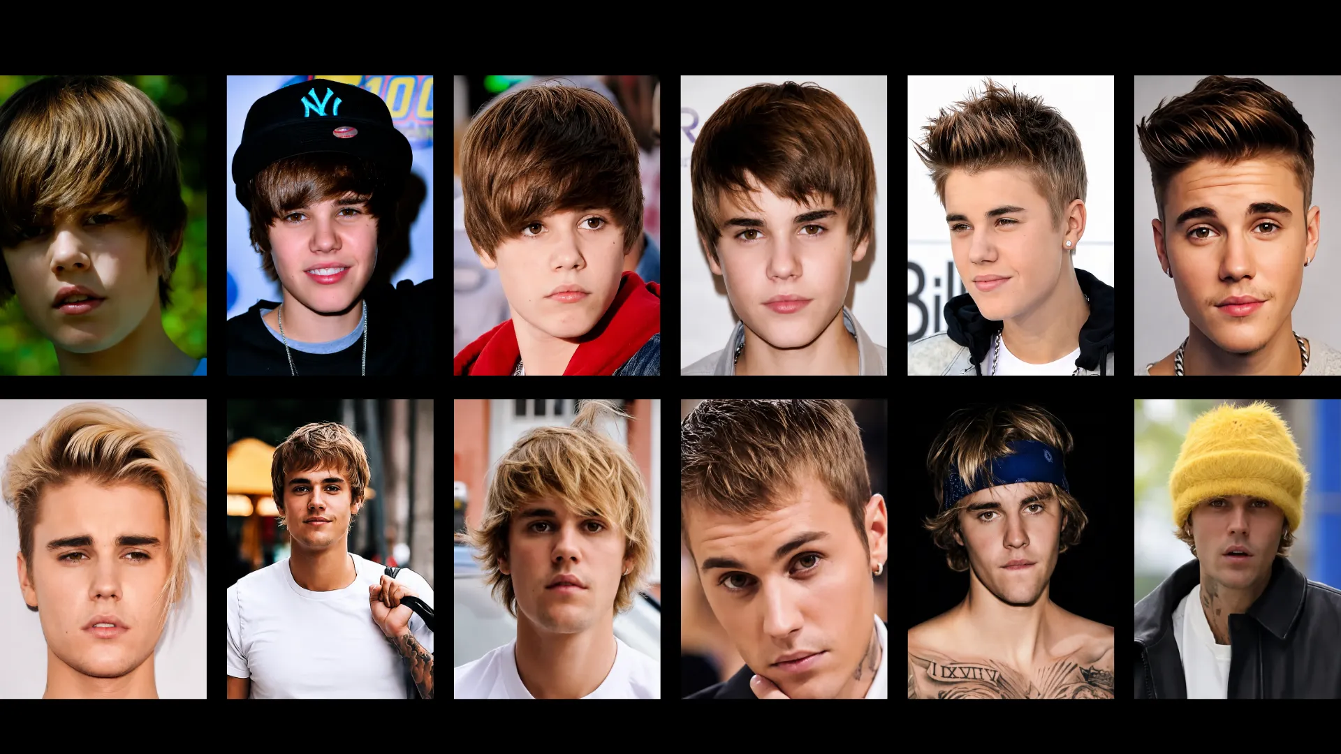 Justin Bieber hairstyle evolution collage showing hairline, haircut, and hair density changes over the years