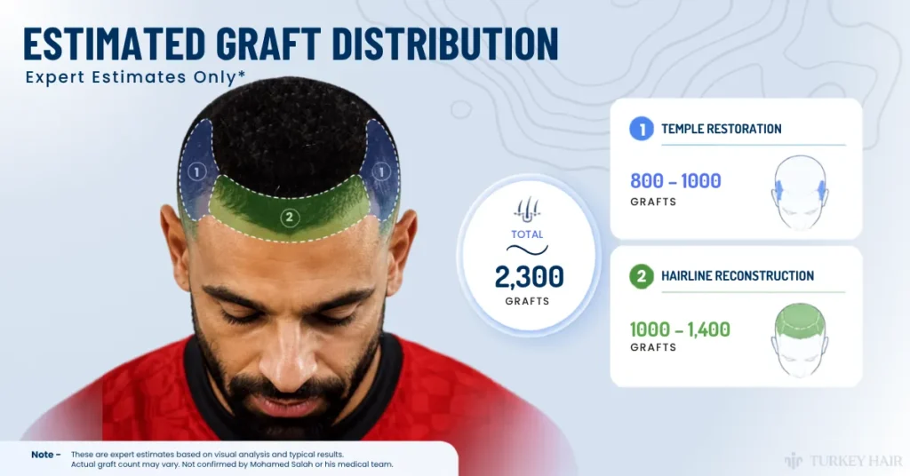 mohamed salah hair transplant grafts, how many grafts did mohamed salah get, mohamed salah graft count, hairline reconstruction grafts, temple restoration grafts, FUE graft distribution, celebrity hair transplant graft estimate