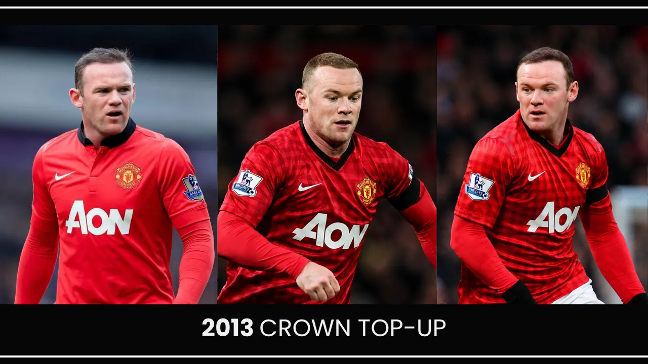 Wayne Rooney 2013 crown top-up procedure showing maintained hair density and continued hair restoration results