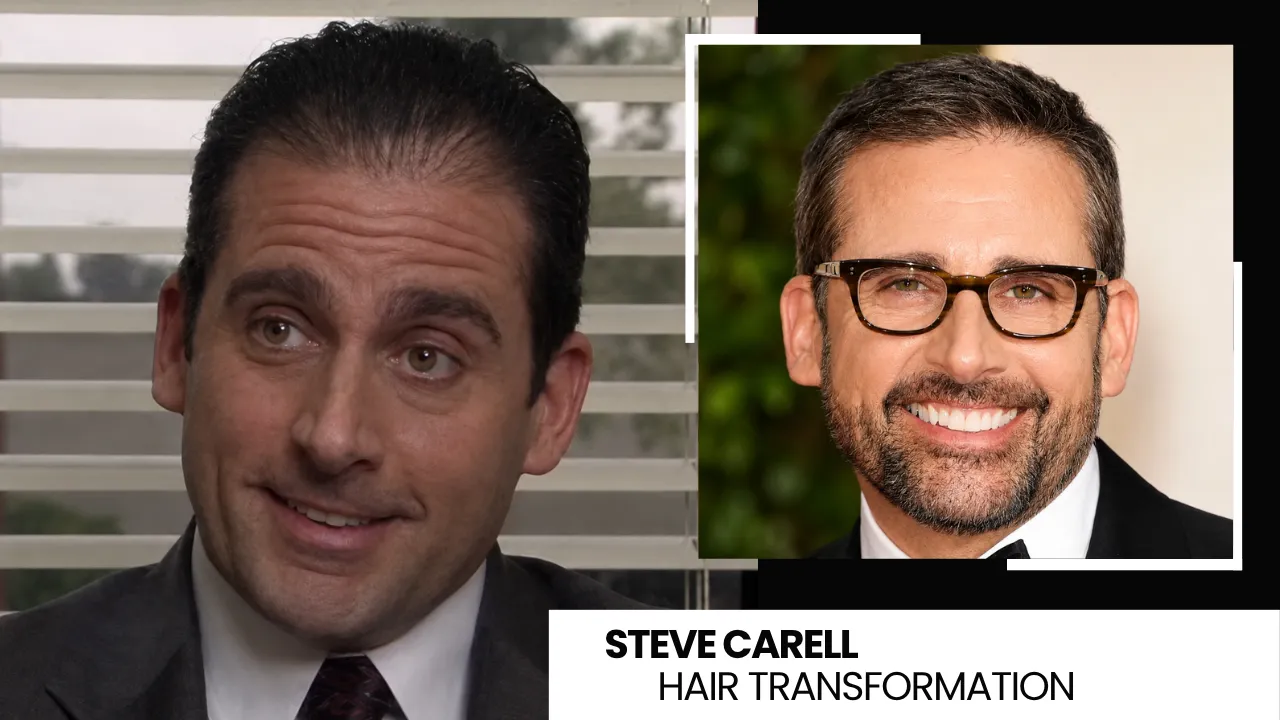 Steve Carell Hair Transplant: Before and After Hairline Analysis