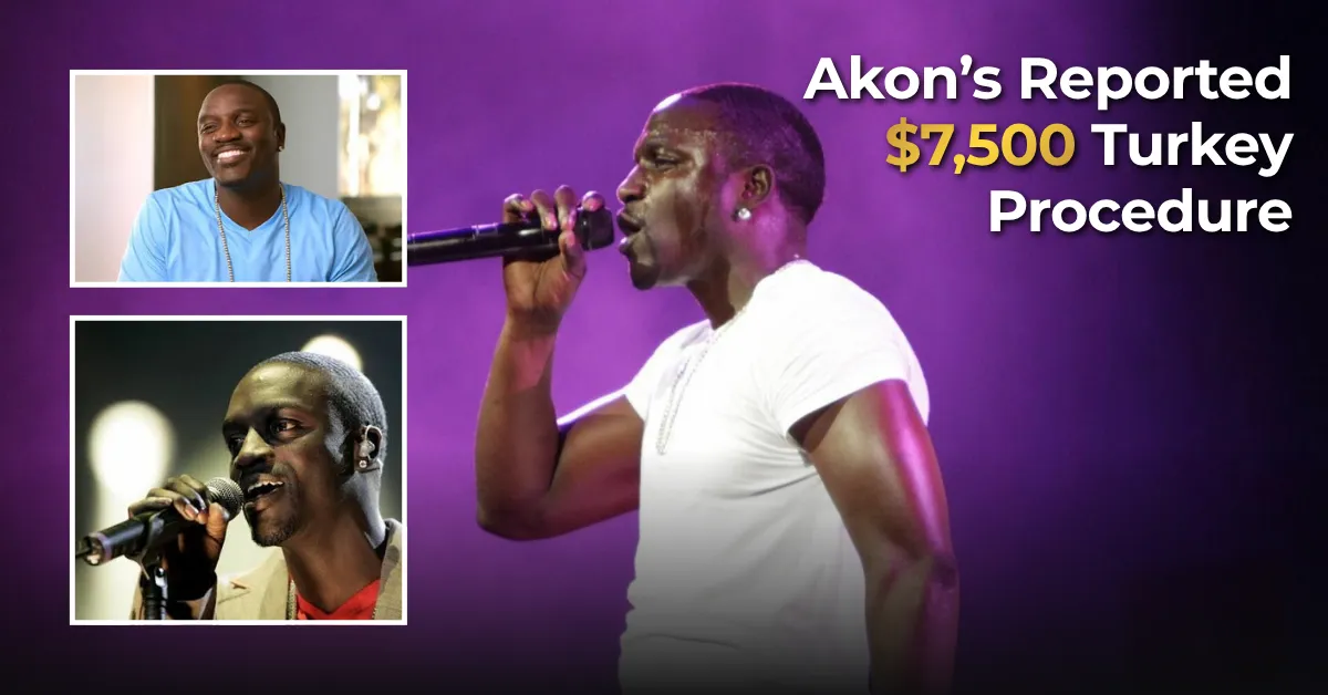 Akon reported hair transplant, Akon Turkey hair transplant, Akon 7500 Turkey procedure, Akon hair transplant rumors, celebrity hair transplant Turkey, Akon hair restoration story, Akon hairline repair