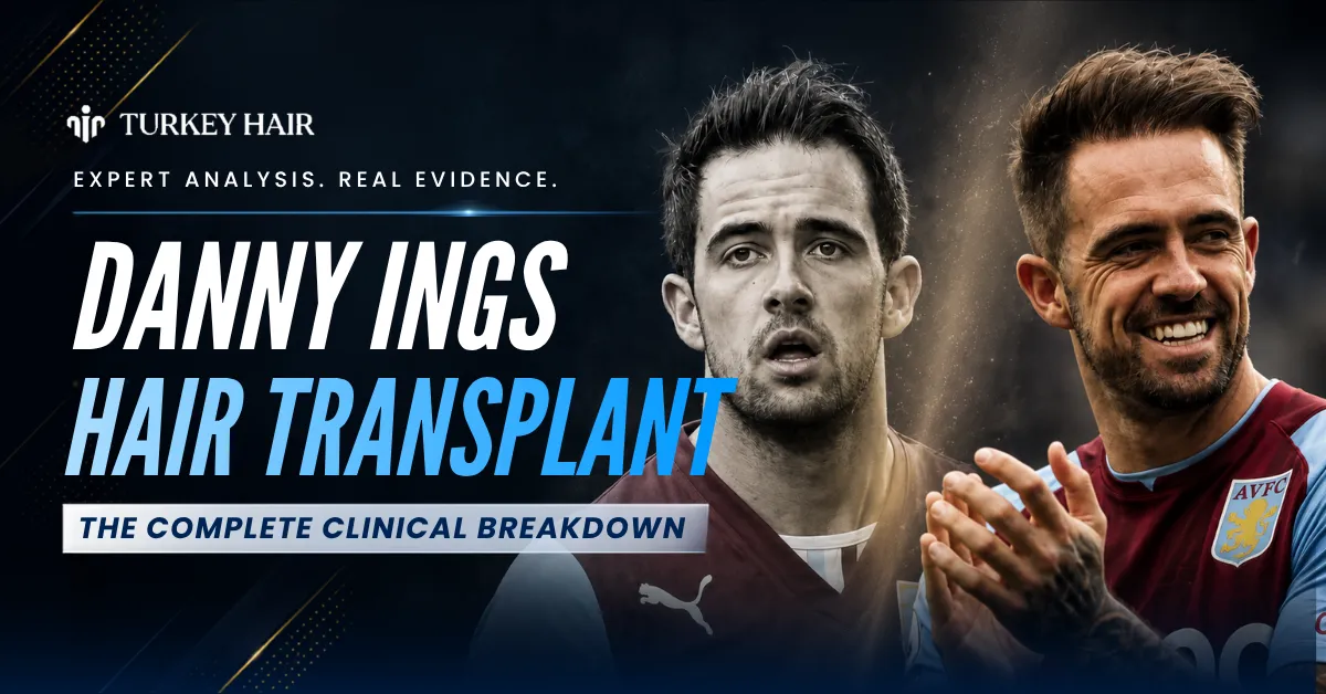 Danny Ings Hair Transplant: Before & After Photos, Cost & Grafts