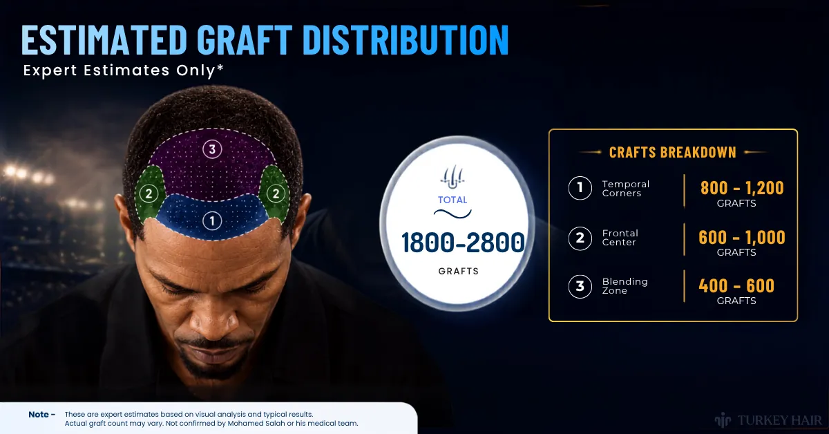 Jamie Foxx Hair Transplant: Head Tattoo, Hairline & Before-After Truth