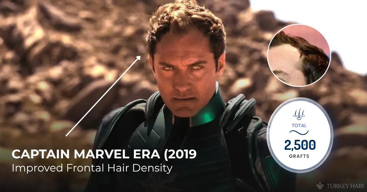 Jude Law, Captain Marvel, hairline, hair loss, law, hair transplant