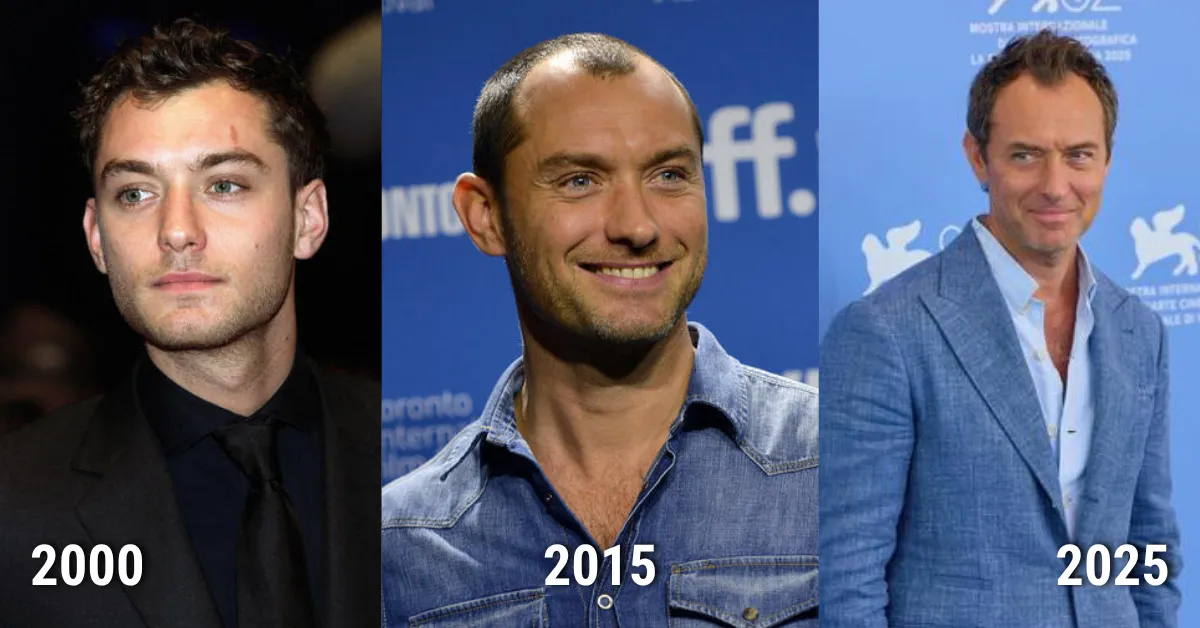 Jude Law, hairline evolution, hair density, celebrity, law, hair