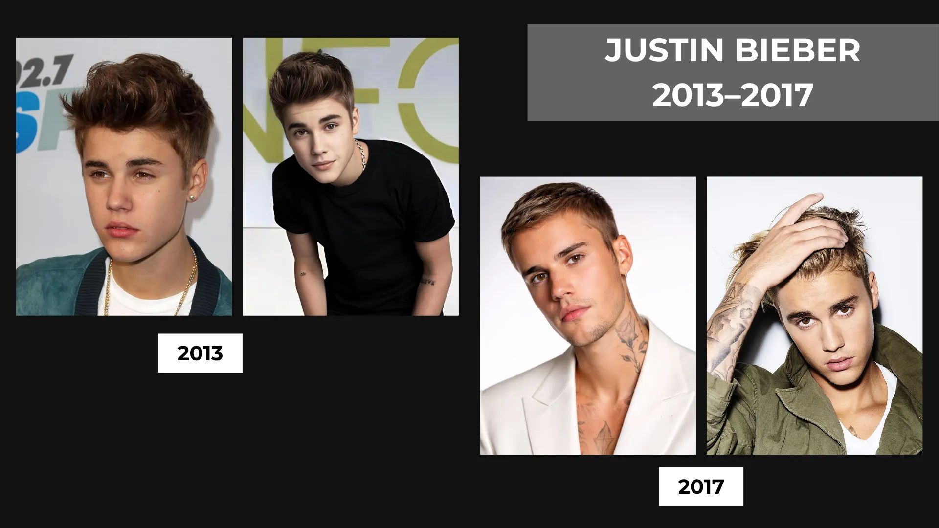 Justin Bieber Hair Transplant: Hairline Analysis, Before & After Photos, Rumors & Expert Opinion